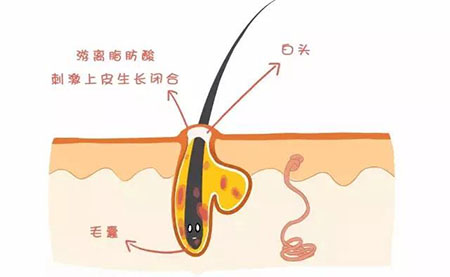 “閉口”這個磨人的小妖精又出來作妖啦！