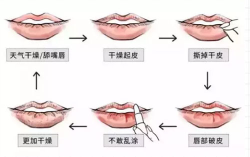 誰(shuí)說(shuō)夏天不用護(hù)唇膏?沒(méi)有它，再貴的口紅都沒(méi)用!